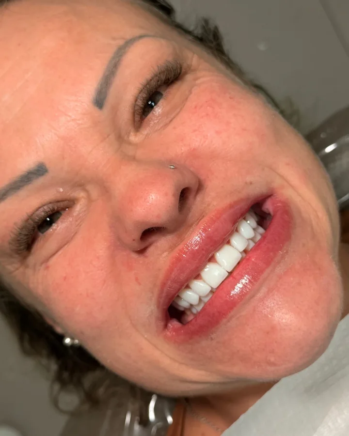 Paciente sorrindo com os dentes novos